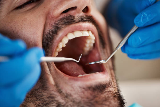 Professional Emergency Dentist in MS